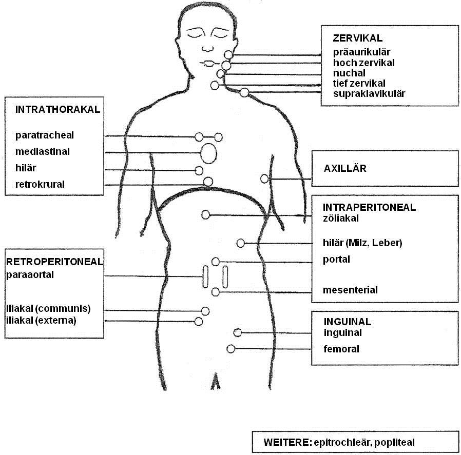 Diffuses Großzelliges B-Zell-Lymphom (Stand November 2014) — Onkopedia